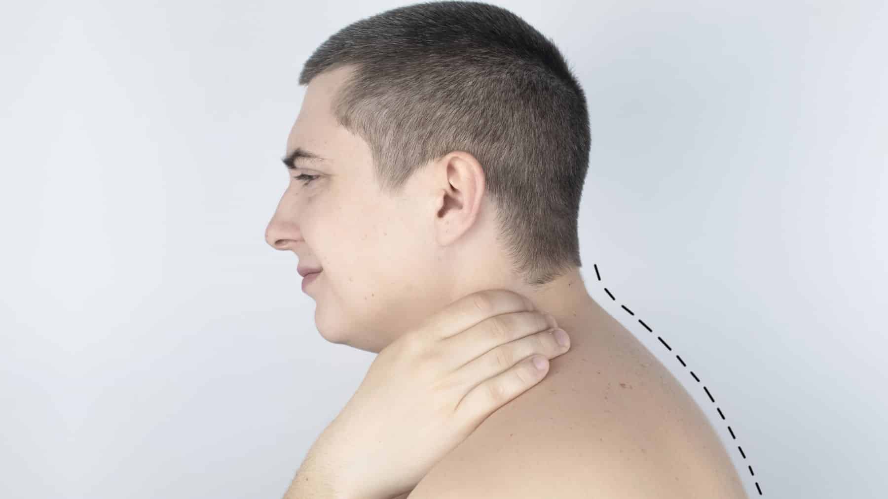 stawy międzywyrostkowe